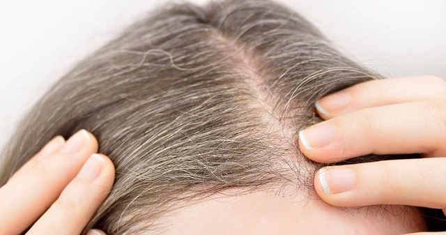 Gene Causing Whiteness in Hair, Gene Causes White Hair - Kfoods